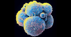 الولايات المتحدة تبدأ أول تجربة للعلاج بالخلايا الجذعية الجنينية
