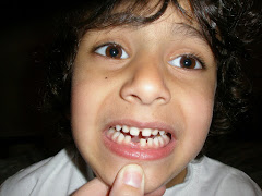 Toothless Adam (March 2008)