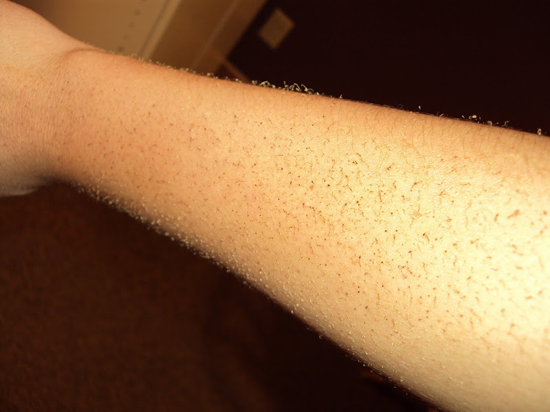 OUR LIFE AS AN AIR FORCE FAMILY Burned Hair