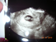Is it a boy or a Girl:) 8 weeks along!