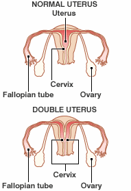 [double+uterus.gif]