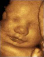 Image Result For  Gambar Bayi Masih Dalam Kandungan
