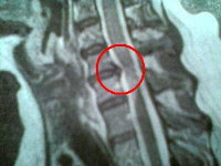 MRI View 1