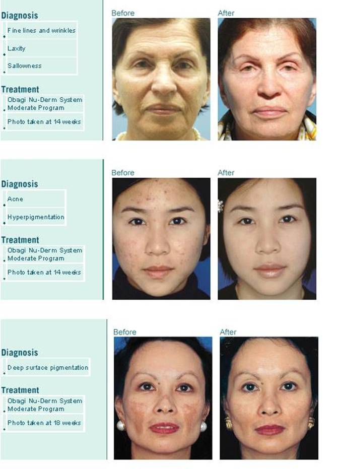 Chasing Bernadette NeuroEVENTS 11 Years of Healthy Skin by Obagi Chasing Bernadette NeuroEVENTS 11 Years of Healthy Skin by Obagi