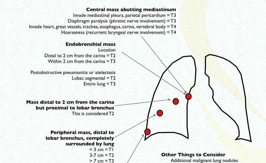 stage-3-lung-cancer-definition-rit-radiology-2009-non-small-cell-lung