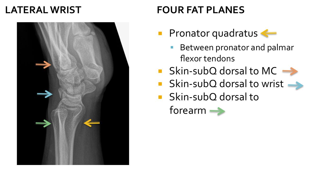 RiT radiology Soft Tissue Evaluation on Wrist Radiography
