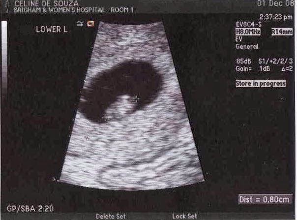 [6w4d-#1.JPG]