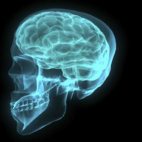 [cuidadoalzheimer_los-enfermos-de-alzheimer-y-los-tumores-cerebrales.png]