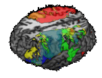 [nuevo.test.cerebro.antecedentes.familiares.beta.amiloide.gif]