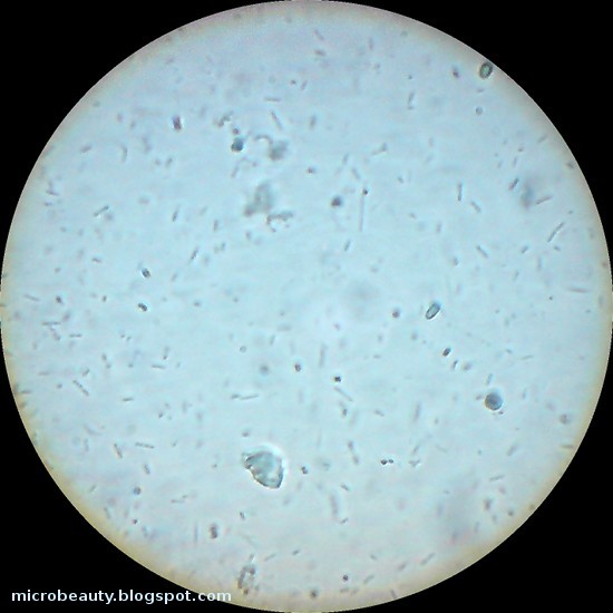 The Wonderful Microworld: Microorganisms in water.