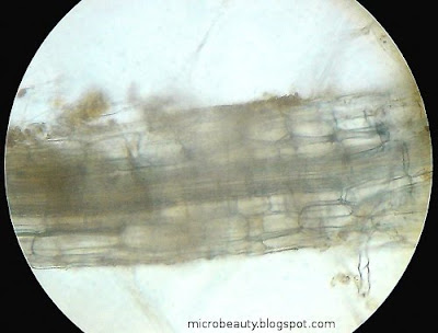Root cells