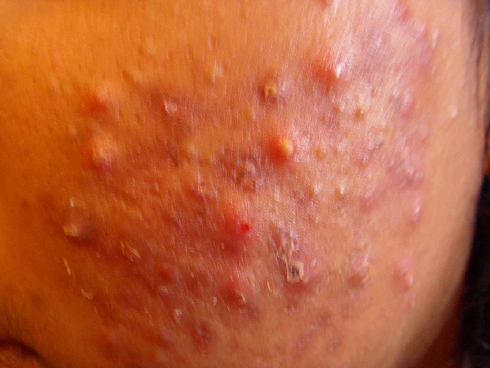 pictures of skin problems