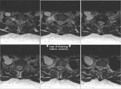 neuroradiology