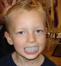 "Trevor what BIG teeth you have!"
