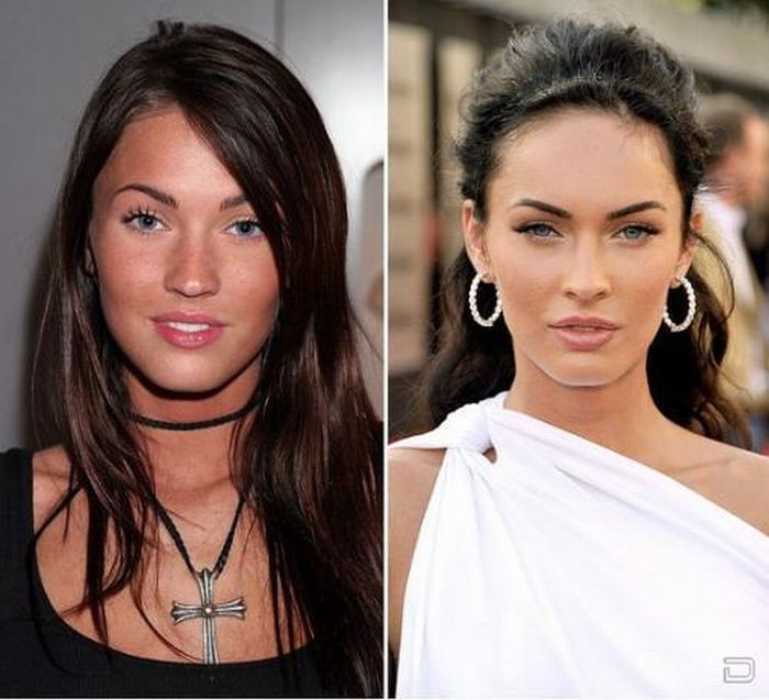 Celebrity Noses Before And After Funny Crazy
