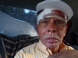 traslado al centro luego de ser operado de un tumor en la cabeza