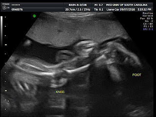 The Heard Life: 27 week ultrasound