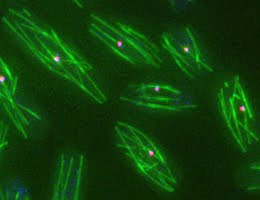 分裂酵母のある変異体における細胞質微小管構造