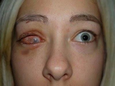 Forum Image: http://3.bp.blogspot.com/_ivIM9ImuNF4/Sg0tgQlqYnI/AAAAAAAABpE/s92sFMtOrKo/s400/jovana+kovacevics.1jpg