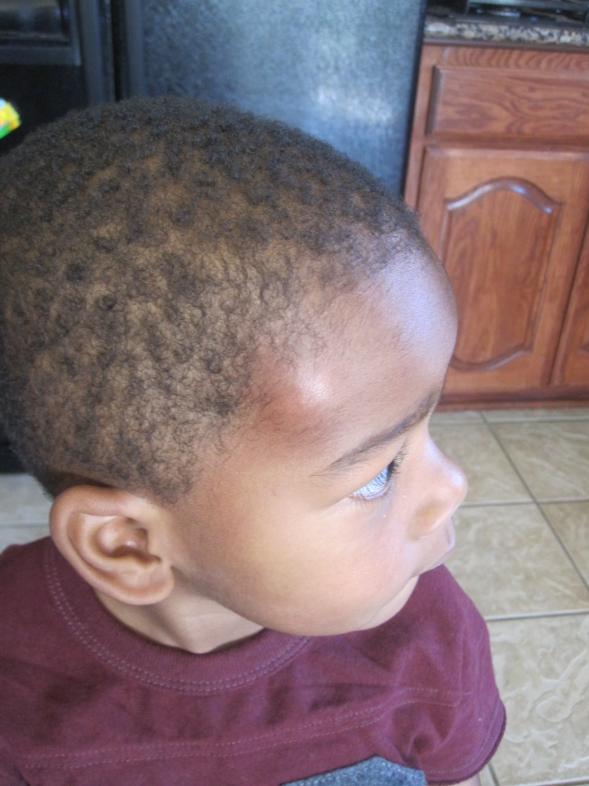 blessed beyond measure mosquito bites.