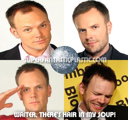 Joel Mchale Has Hair Plugs Ign Boards Img