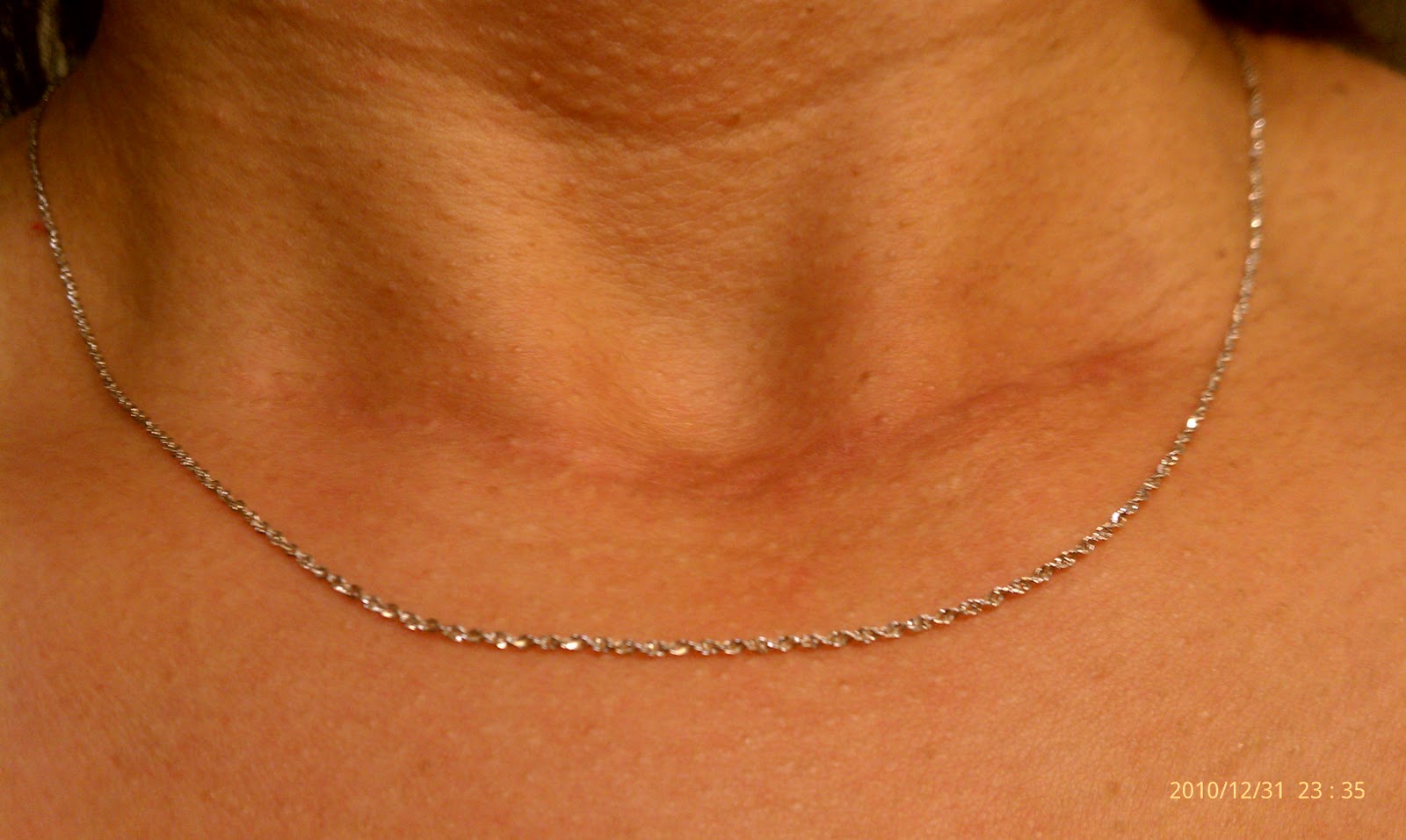 How does my neck look?: How does my neck look? 1/1/11