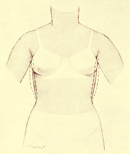 [UNDER+ARM.jpg]