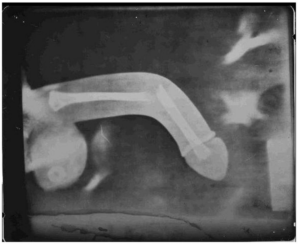 [Raio-X-Baixa-724401.jpg]