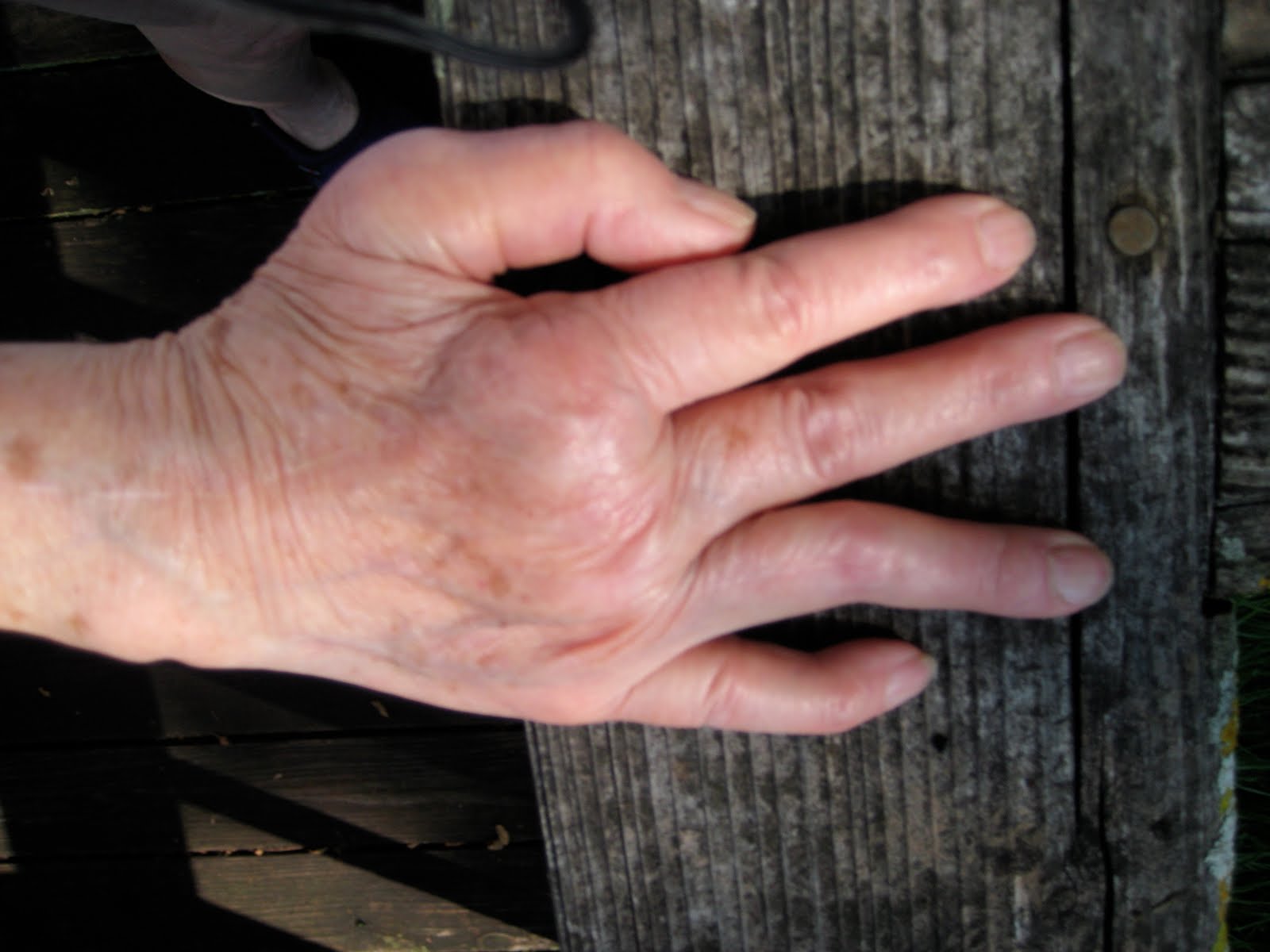 Kitchen Utensils For Arthritic Hands