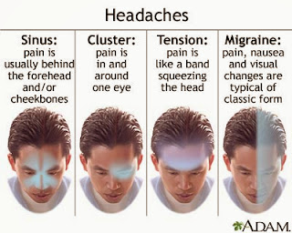 NATURE CURE: Headaches and its cure by Mudra,Yoga Kriyas,natural herbs