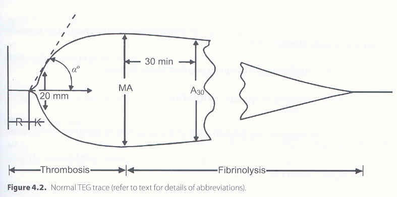 Pedi Cardiology Thromboelastogram TEG Result Interpretation pedi-cardiology-thromboelastogram-teg-result-interpretation