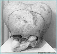 http://3.bp.blogspot.com/_lR3UVB42m9I/Sdf3Ip4j4eI/AAAAAAAAAcg/tpJplg9l-bw/s200/2007-03-27-xl--Craneo_tipo_M.jpg