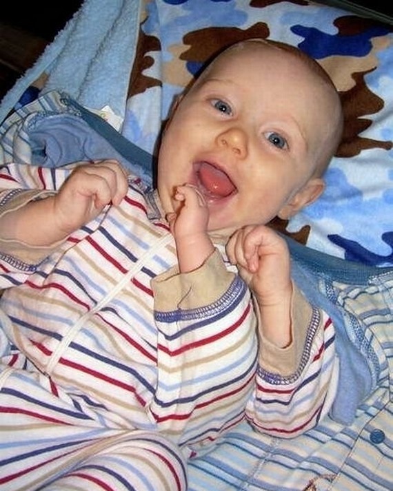 Three Armed Baby Shots one and only in the world oldShotsWorld