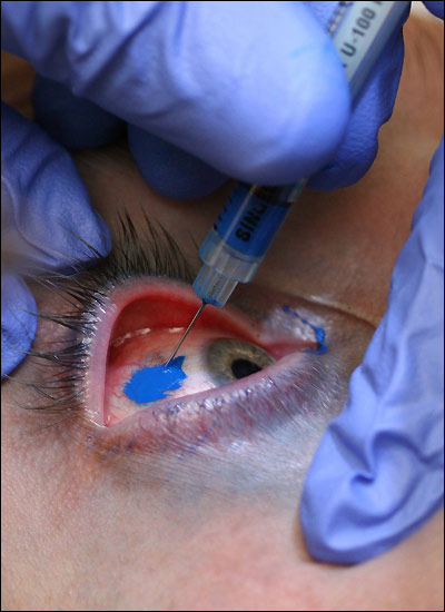 eye_tattoo_1.jpg