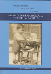 ATLANTE DI DERMATOLOGIA PEDIATRICA DA VIRUS