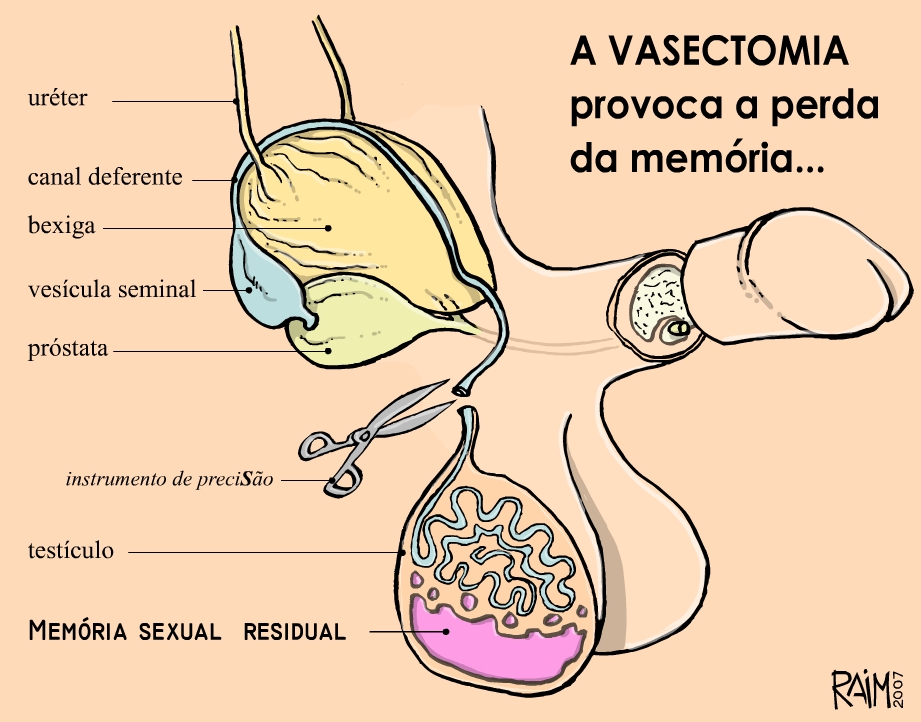 [x_vasectomia_01.jpg]
