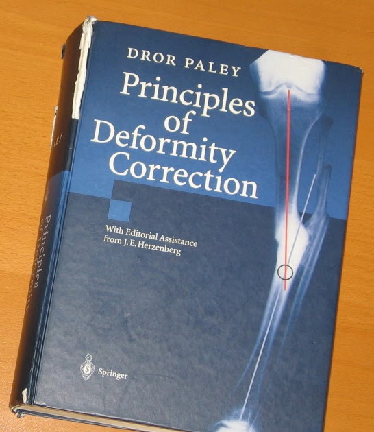 Paley Principles Of Deformity Correction Pdf Free Apps