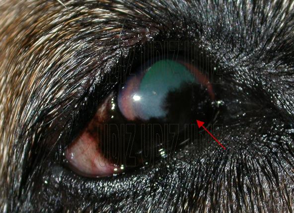 Krónikus prostatitis