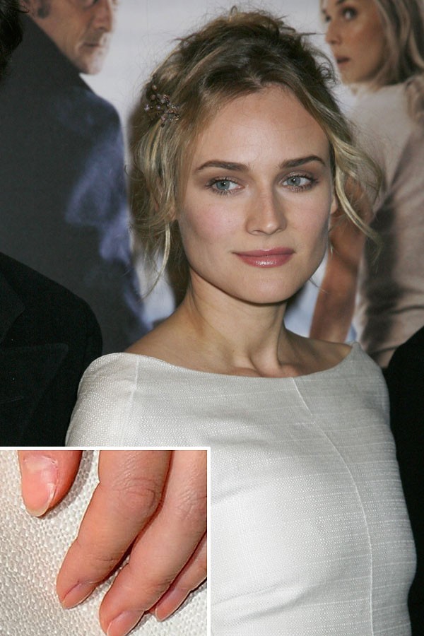 [celebrity_microscope_14.jpg]