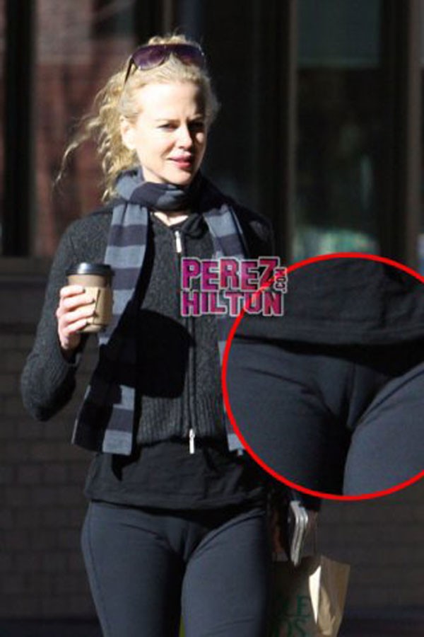 [celebrity_microscope_29.jpg]