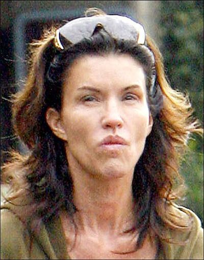 [Celebrities_Without_Makeup_10.jpg]