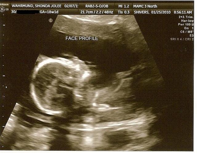 [Baby+W3+(Small).JPG]