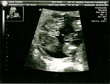 Definetly a Boy!