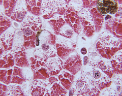 [Glycogen+-+stain.jpg]