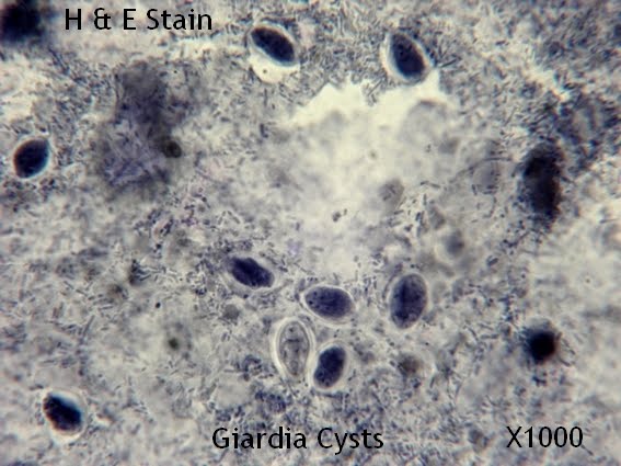giardia cysts 3 szubkután parazitafertőzés