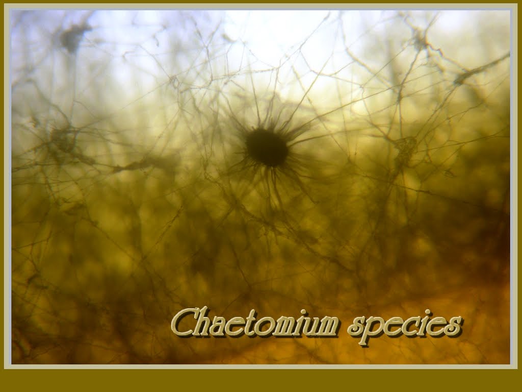 Fun With Microbiology (What's Buggin' You?): Chaetomium Species