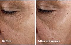 neutrogena ageless intensives deep wrinkle moisture