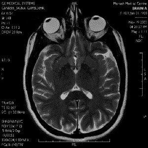 [090117-mri.jpg]