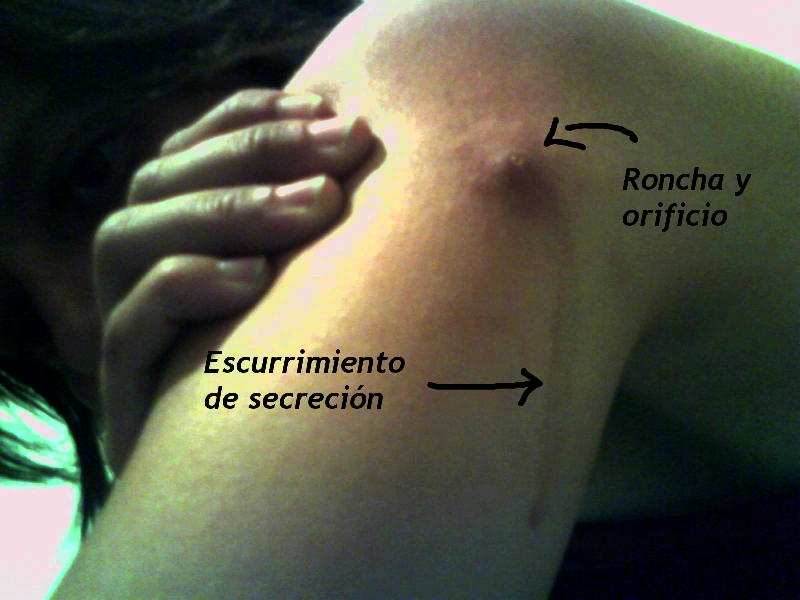 dermatobia+hominis+mes+y+medio.jpg dermatobia+hominis+mes+y+medio.jpg