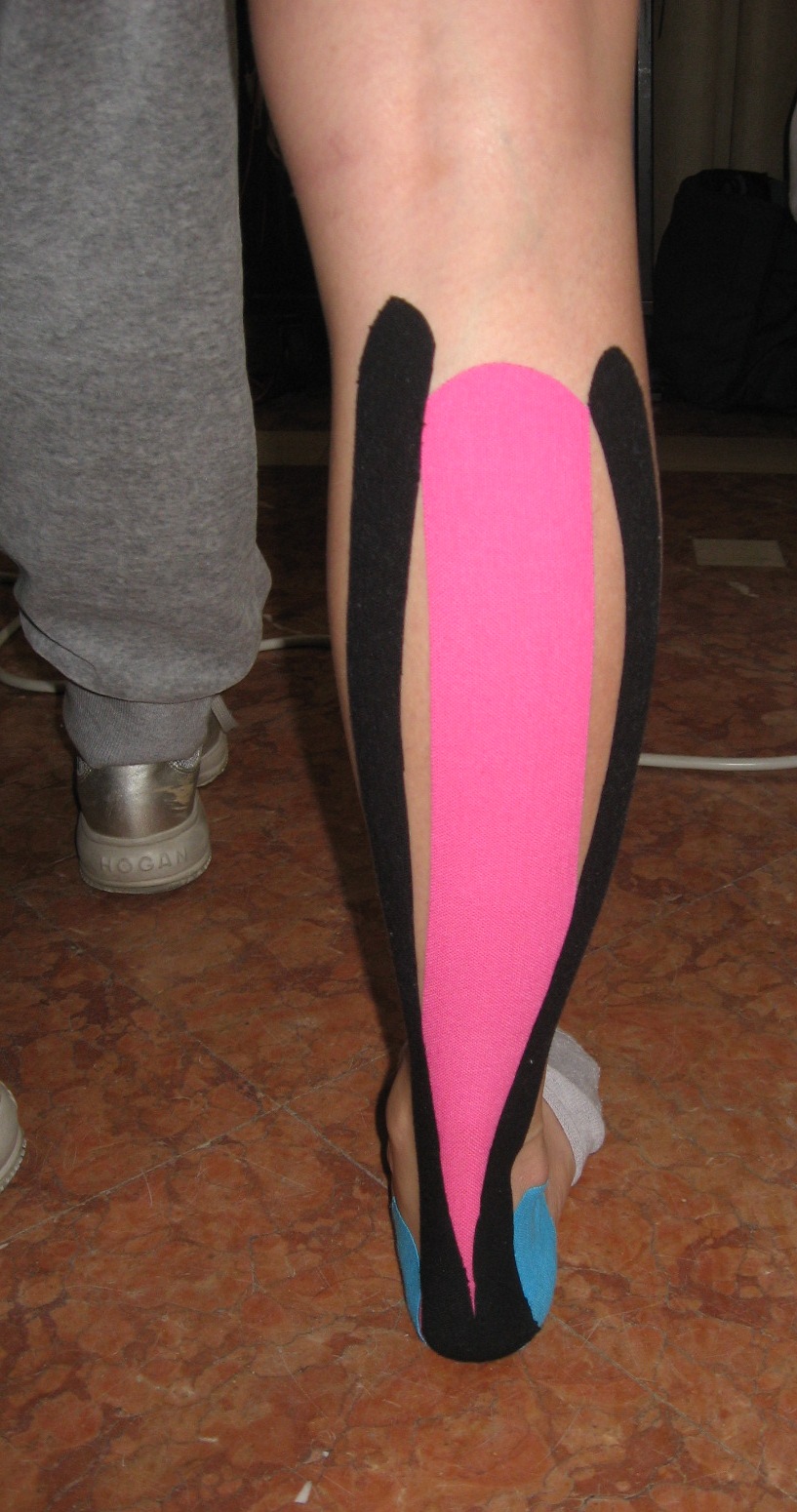 Schiena OK Kinesio Taping